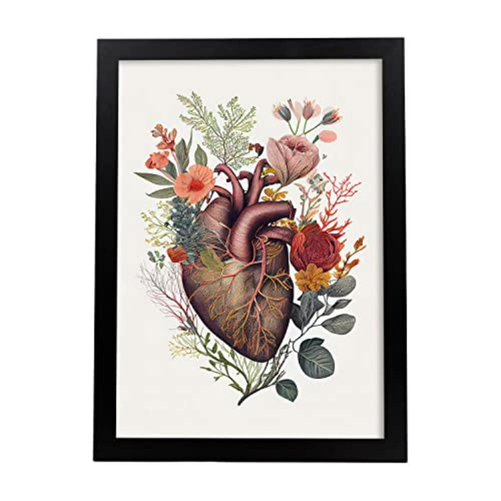POSTER Anatomie Herz A4 Schwarzer Rahmen - Schwarz, Papier (29.7/5/21cm) - Nacnic