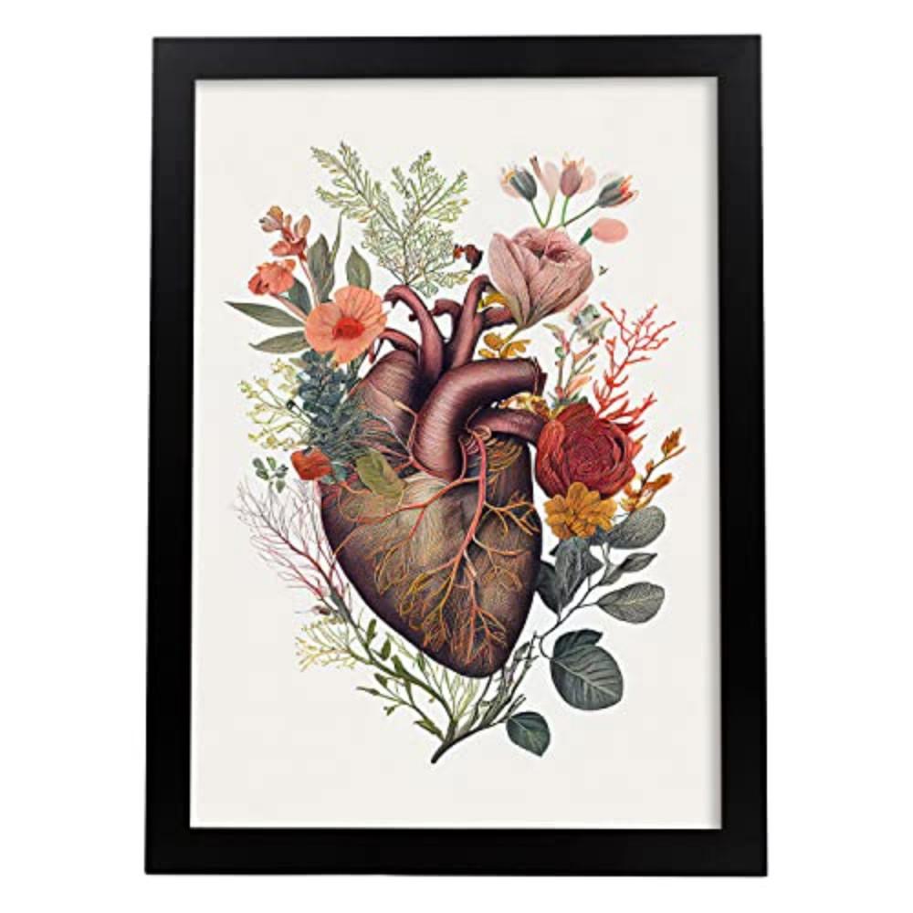 POSTER Anatomie Herz A3 Schwarzer Rahmen - Schwarz, Papier (29.7/5/42cm) - Nacnic