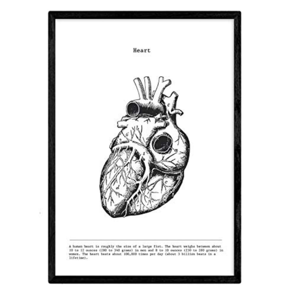 POSTER Anatomie Herz A3 Schwarzer Rahmen - Schwarz, Papier (29.7/5/42cm) - Nacnic