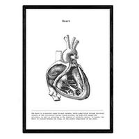 POSTER Anatomie Herz A4 Schwarzer Rahmen - Schwarz, Papier (29.7/5/21cm) - Nacnic