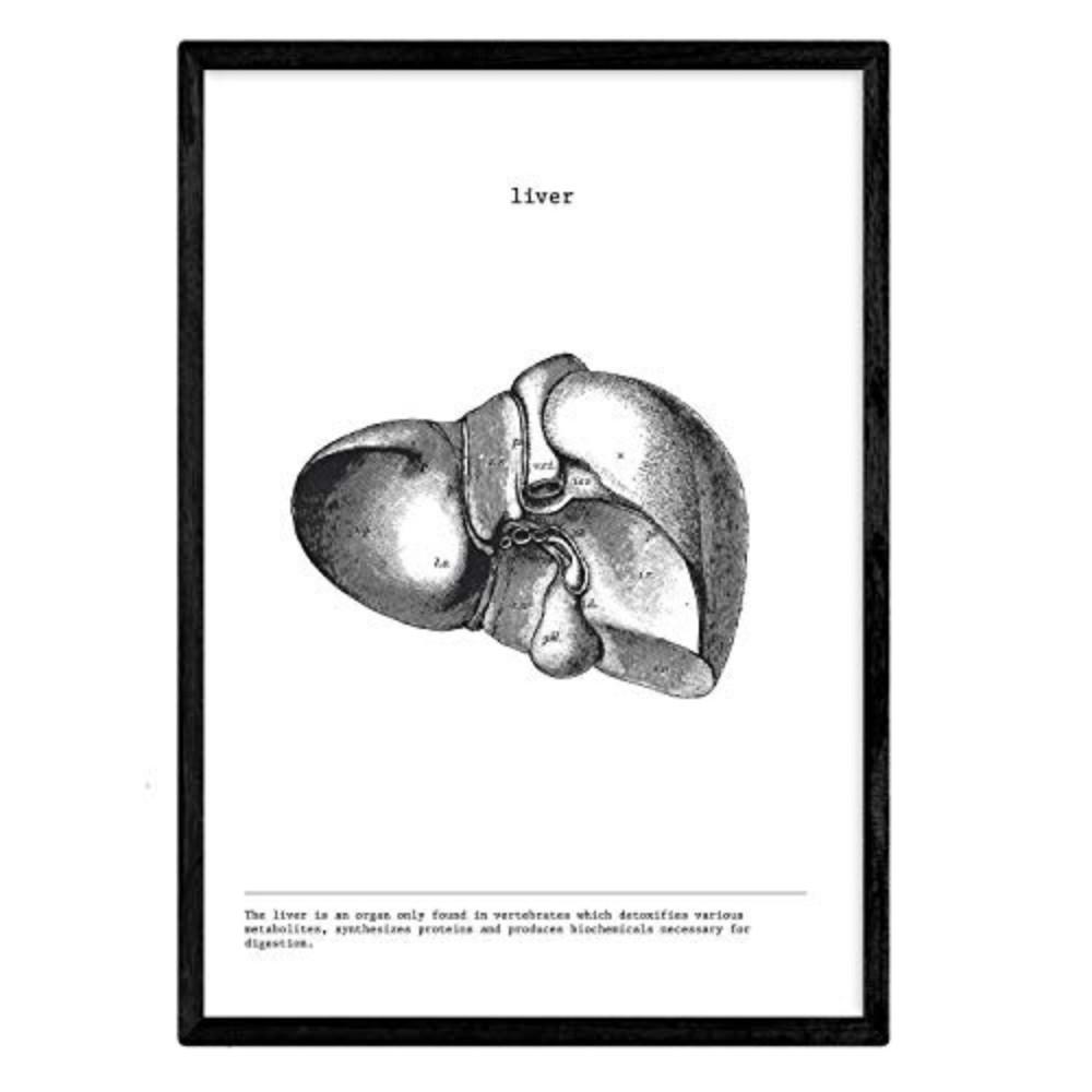 POSTER Anatomie Leber A3 Schwarzer Rahmen - Schwarz, Papier (29.7/5/42cm) - Nacnic