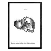 POSTER Anatomie Leber A3 Schwarzer Rahmen - Schwarz, Papier (29.7/5/42cm) - Nacnic