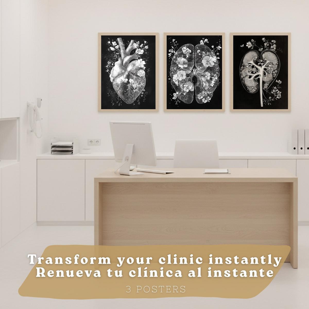 POSTER Set aus 3 Anatomie Drucke und mit Inneren Organen Gehirn Herz Nieren Minimalistisches Schwarz Weiß Design Größe Leichter Holzrahmen A4 - Beige, Papier (21/29.7/3cm) - Nacnic