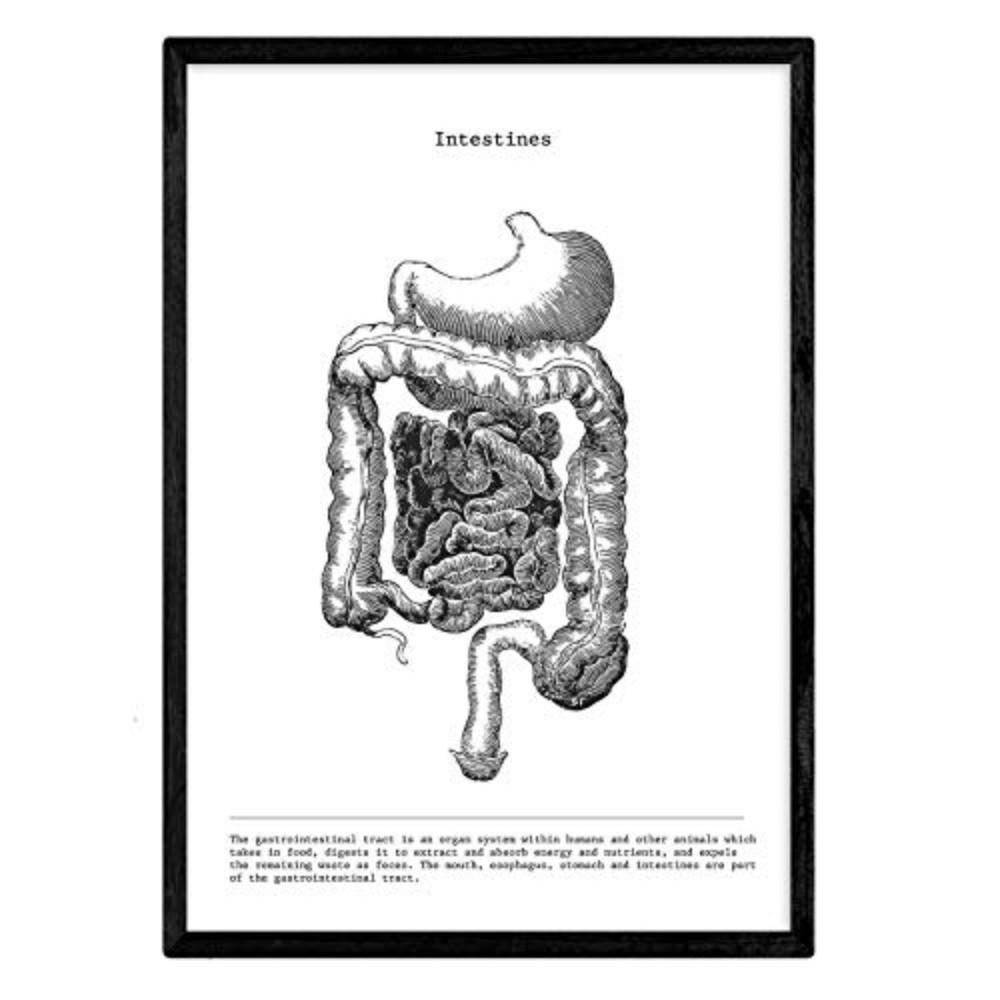 POSTER Anatomie Darm A3 Schwarzer Rahmen - Schwarz, Papier (29.7/5/42cm) - Nacnic