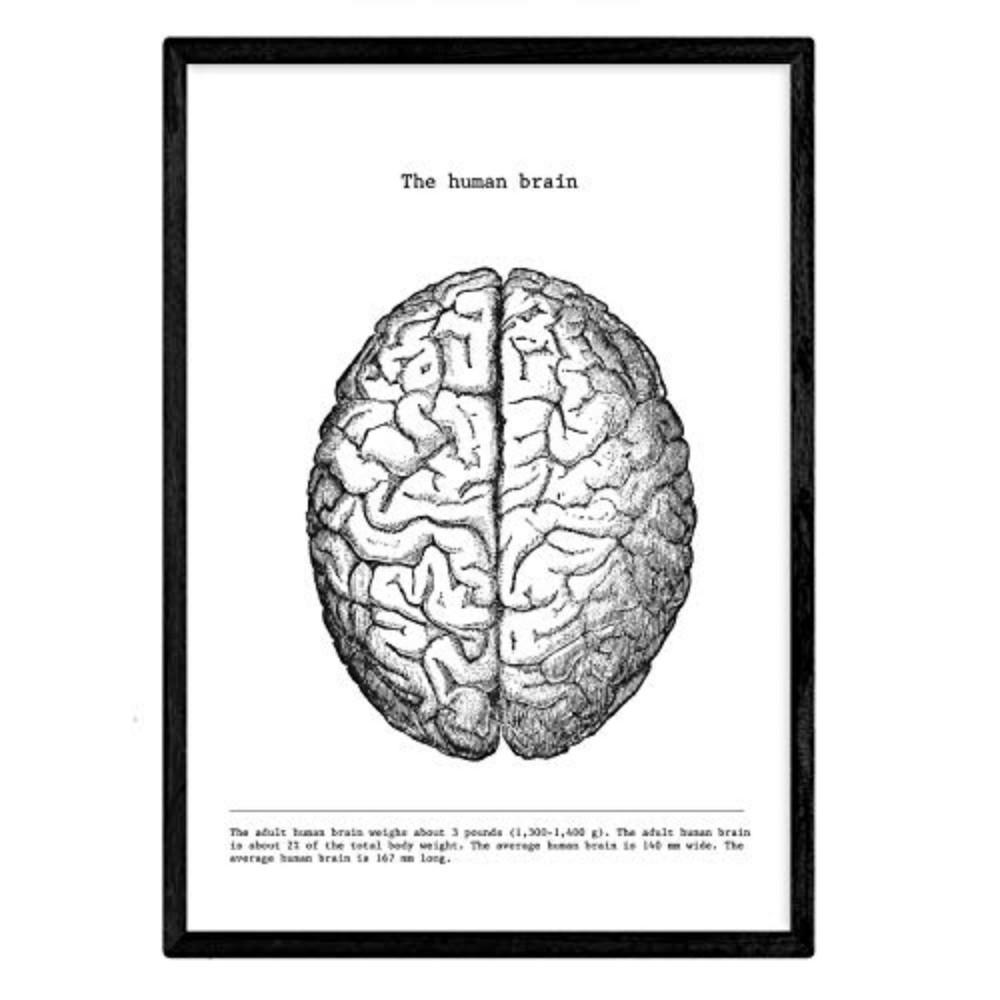 POSTER Anatomie Gehirn A3 Schwarzer Rahmen - Schwarz, Papier (29.7/5/42cm) - Nacnic