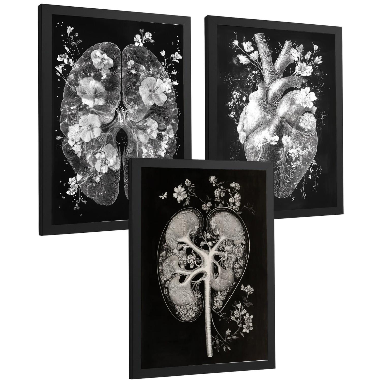 POSTER Set aus 3 Anatomie Drucke und Wandbilder mit Inneren Organen Gehirn Herz Nieren Minimalistisches Schwarz Weiß Design Größe Schwarzer Rahmen A3 - Schwarz, Papier (29.7/42/3cm) - Nacnic