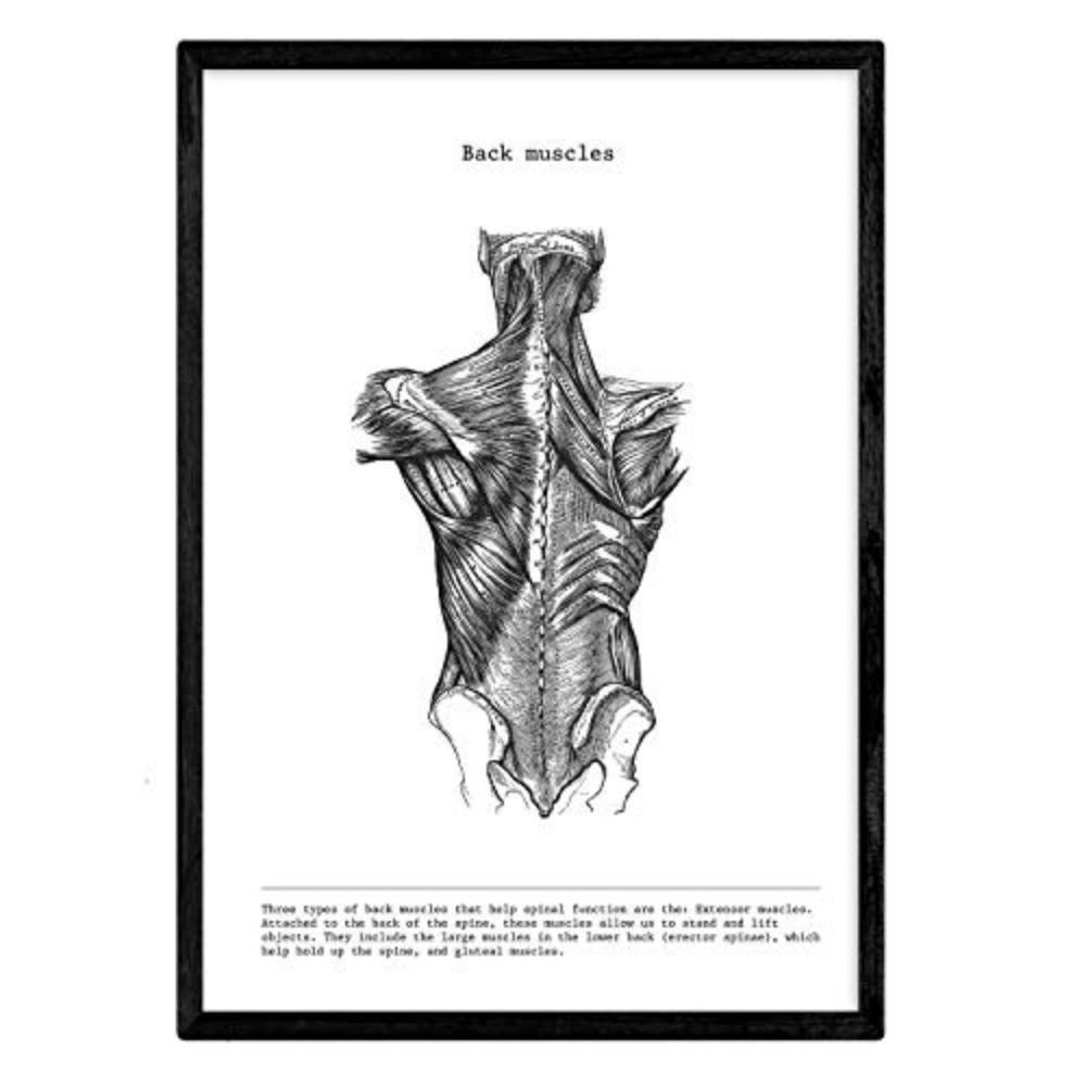 POSTER Anatomie Muskeln & Knochen Rücken A4 Schwarzer Rahmen - Schwarz, Papier (29.7/5/21cm) - Nacnic