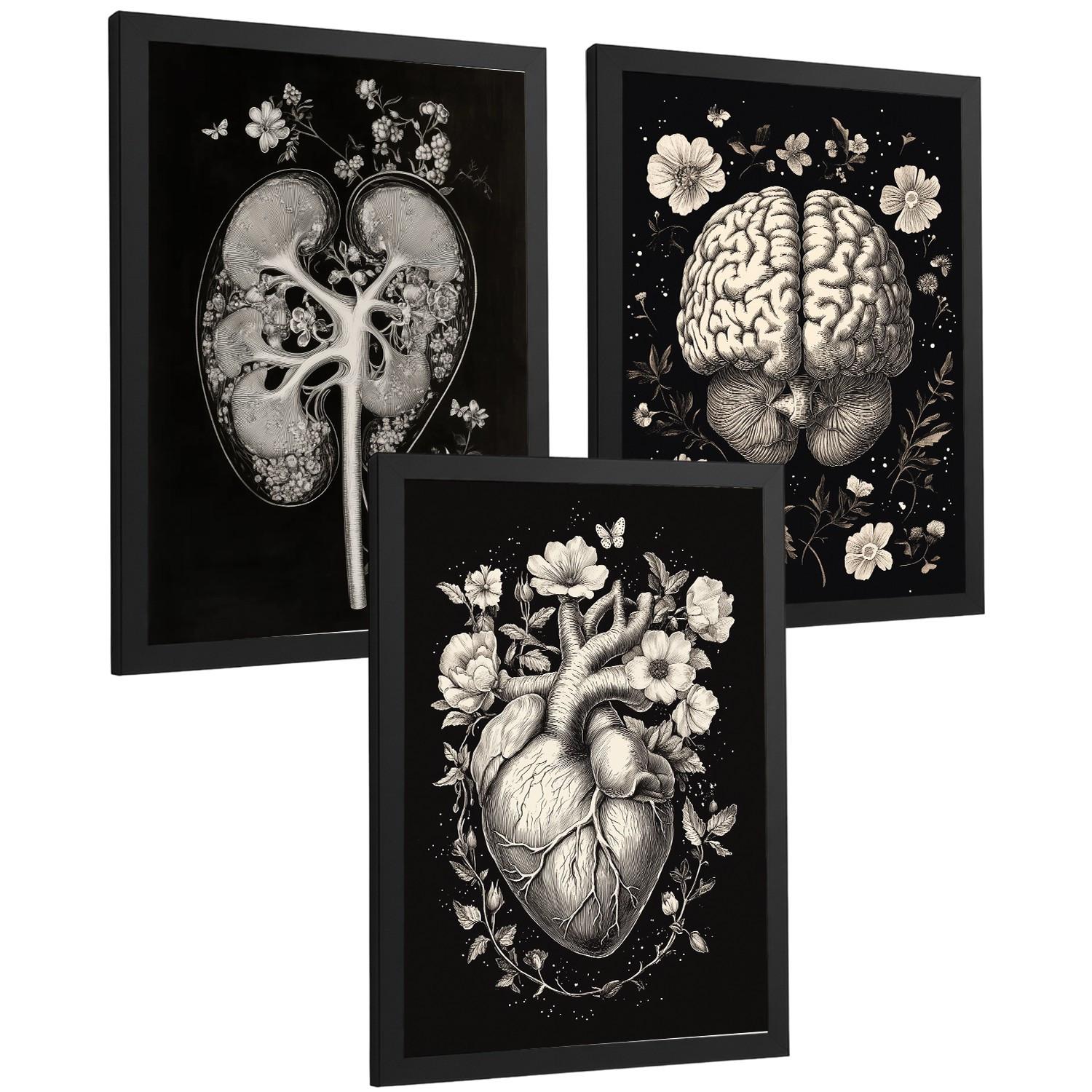 POSTER Set aus 3 Anatomie Mensch Drucke und Wandbilder mit Niere Harnsystem Gehirn und Herz Klassisches Schwarz Weiß Design Größe Schwarzer Rahmen A4 - Schwarz, Papier (21/29.7/3cm) - Nacnic